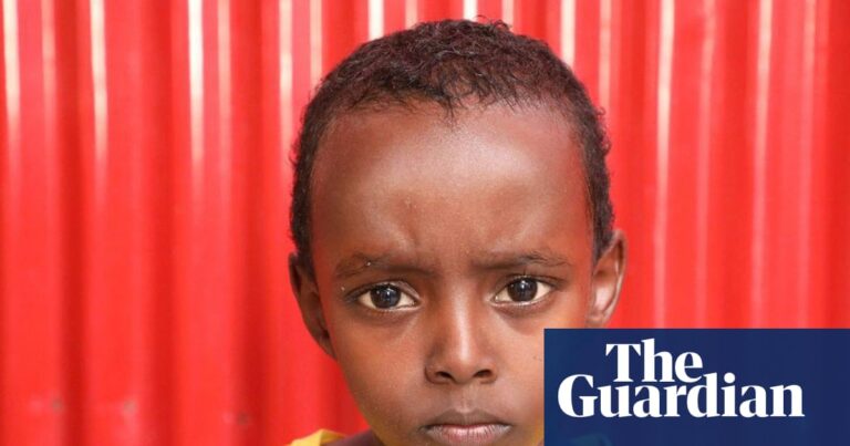 Seven-year-old Abdiqadir Salah, a Somali boy, injured by shrapnel from a US airstrike, lying in a hospital bed.