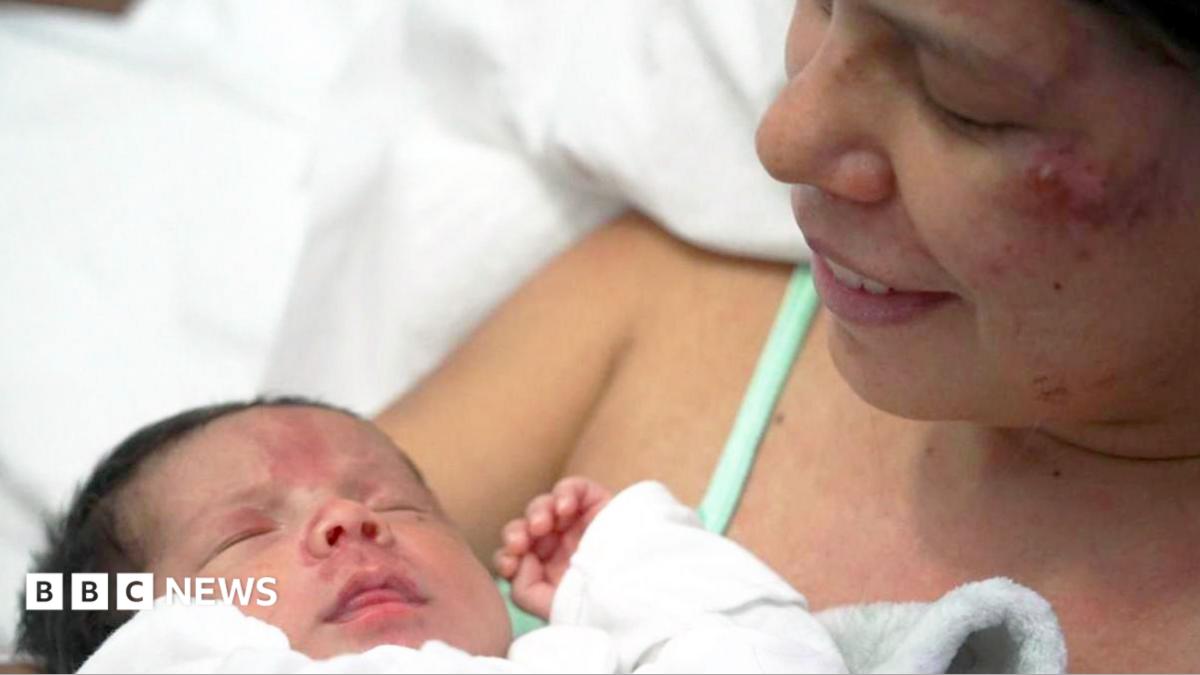 Mother Dayana Patino holding her baby Juan David after being rescued from earthquake rubble in Venezuela.